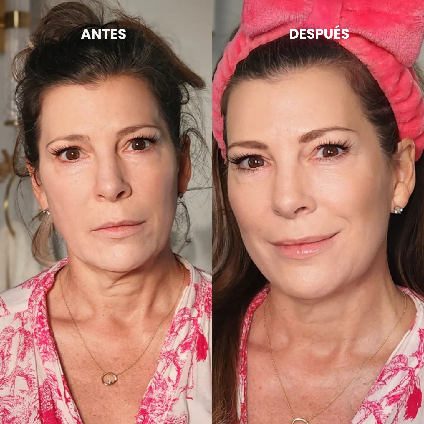 GlowLift - Masajeador Facial Antiarrugas - 3 en 1